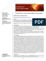 Cervical Tear: A Rare Route of Delivery: Case Report: Bhaktii Kohli and Madhu Nagpal