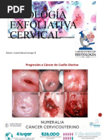 Citología Exfoliativa Cervical