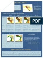 Timpanoplastia