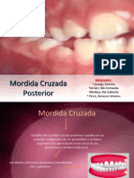 Mordida Cruzada Posterior PRESENTACION FINAL