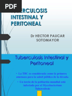 Tuberculosis Intestinal