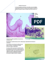 Epitelio de Transicion