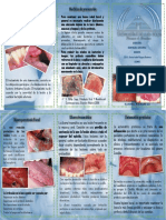 Enfermedades Asociadas Al Uso de Prótesis Dental