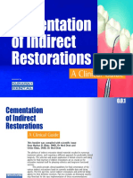 Kuraray Cementation Indirect Restorations Guide