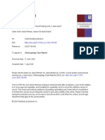 COVID - 19 and Sudden Sensorineural Hearing Loss A