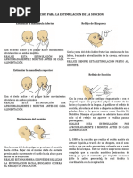 Ejercicios para La Estimulación de La Succión