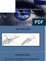 Glaucoma Facomorfico Facolitico y Traumatico