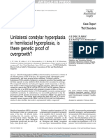 Unilateral Condylar Hyperplasia in Hemifacial Hyperplasia, Is There Genetic Proof of Overgrowth?