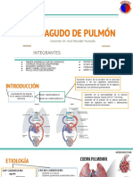 Edema Agudo Pulmon