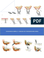 Guia Clinica. Exodoncia Simple y Cirugia Tercer Molar