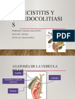 Colecistitis y Coledocolitiasis