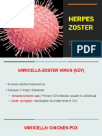 Herpes Zoster: Shingles Acute Posterior Ganglionitis