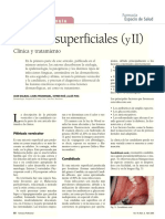 Micosis Superficiales (II) : Clínica y Tratamiento