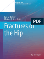 Fractures of The Hip