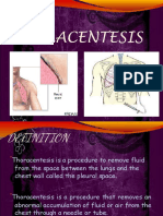 Thoracentesis - Paracentesis