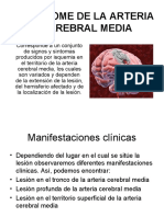 Sindrome de La Arteria Cerebral Media