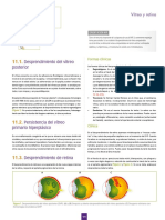 Vitreo y Retina