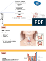 Tiroides