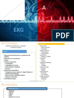 Arritmias y ECG