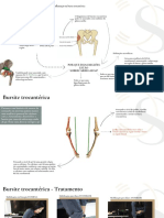 Mapa Mental - Bursite Trocantérica