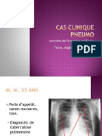 Cas Clinique Pneumo