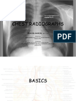 Chest Radio Graphs 2