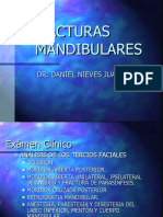 Fracturas Mandibulares y de Condilo