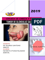 Tumor de Glandulas Salivales