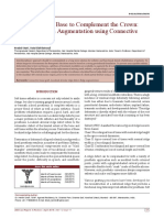 Supplement The Base To Complement The Crown: Localized Ridge Augmentation Using Connective Tissue Graft