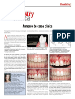 Cirurgia de Aumento de Coroa Clínica