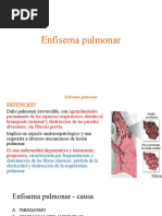 Enfisema Pulmonar