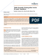 A Case of Body Stalk Anomaly Arising After Invitro Fertilization at 26 Week' Gestation