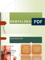 Hernia Hiatal