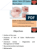 Vein of Galen Malformation