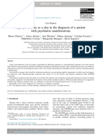 2-Hyperprolinemia As A Clue in The Diagnosis of A Patientwith Psychiatric Manifestations