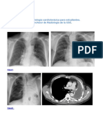 Album de Casos de Radiología Cardiotorácica Enero