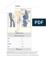 Insuficiencia Venosa