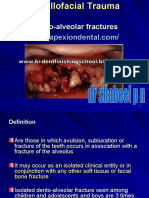 Dento Alveolar Fractures