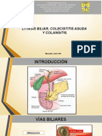 Litiasis Vesicular, Colecistitis y Colangitis