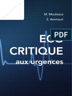 Ecg Critique