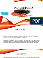 ADENOIDECTOMIA