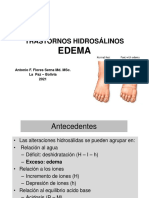 Edema