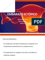 Embarazo Ectopico