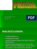 Etiology of Malocclusion