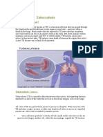 What Is Tuberculosis?