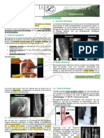 RX de Esófago, Estomago y Duodeno