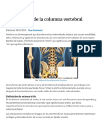 Osteoartritis de La Columna Vertebral