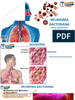 Neumonia Por Bacterias y Hongos.