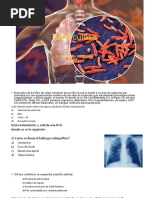 Tuberculosis Examen