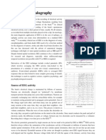 Electroencephalography: Source of EEG Activity